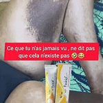 Charger l'image dans la galerie, Fevicid Crème – Anti-Mycoses, Tâches Noires et Boutons de Rasage - GN
