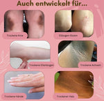 Charger l'image dans la galerie, FootCare™ – Contre les mycoses, l’eczéma et la peau craquelée, régénérant, hydratant et à l’arnica [1 + 1 Gratuit]
