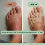 Charger l'image dans la galerie, Masseur Thérapeutique Anti-Douleur
