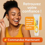 Charger l'image dans la galerie, Fevicid Crème – Anti-Mycoses, Tâches Noires et Boutons de Rasage - GN
